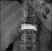 Abb. 5: Lumbar vertebra