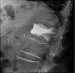 Abb. 6: Lumbar vertebra