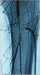 Abb. 5: Thrombusaspirationsembolektomie