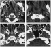 Aktuelles Bild - Abb. 1: Trauma-Scan