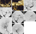 Abb. 1a-h: CTA - Aneurysmen