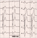 Abb. 1: ECG leads