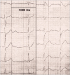 Aktuelles Bild - Abb. 2: ECG leads