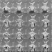 Abb. 1: Makroadenom