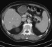 Aktuelles Bild - Abb. 2: Abdomen
