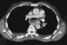 Abb. 1: CT