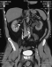 Abb. 1: Abdomen