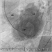 Aktuelles Bild - Abb. 10: Laevokardiogramm