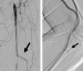 Abb. 1: A. tibialis anterior