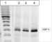 Fig. 2: Aquaporinexpression - Proteinexpression