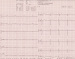 Aktuelles Bild - Abb. 1: EKG