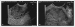Abb. 1a-b: Tumor - Magen