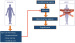 Fig. 2: Transplant Procedure