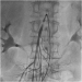Aktuelles Bild - Abb. 1: Arteria mesenterica superior