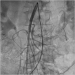 Abb. 3: Aorta abdominalis