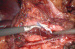 Abb. 2: Transplantat