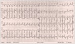 Abb. 1: EKG