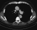 Abb. 2a: Thorax-CT
