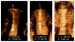 Aktuelles Bild - Abb. 6: Uterushhle