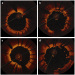 Abb. 1a-d: Stent-Struts