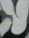 Aktuelles Bild - Abb. 9: PDA