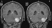 Fig. 2a-b: Brain MRI