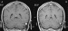 Fig. 4a-b: Brain MRI