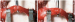 Aktuelles Bild - Abb. 2a-b: Mikroskopische Vasovasostomie