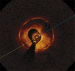 Abb. 5: LASER-Angioplastie