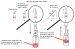 Abb. 1: Sperm preparation