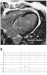 Abb. 1: Septum