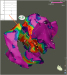 Abb. 2: Elektroanatomisches Mapping