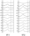 Abb. 3: VT