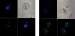 Abb. 3: PCOS