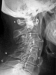 Abb. 1: Rheumapatienten im OP