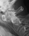 Abb. 2: Rheumapatienten im OP