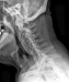 Abb. 3: Rheumapatienten im OP