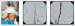 Abb. 2: Rotationsthrombektomie