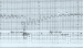 Aktuelles Bild - Abb. 1: Schadensflle-Geburtshilfe
