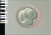 Abb. 2: Produkt: Inversmikroskop<br>Vertrieb: MTG Medical