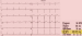 Abb. 2: AED
