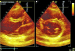 Aktuelles Bild - Abb. 2: Stressechokardiographie