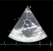 Abb. 4: RVOT