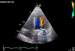 Abb. 3: Farbdoppler