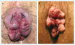 Aktuelles Bild - Abb. 1a-b: Hmorrhoiden