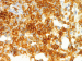 Aktuelles Bild - Abb. 4c: Follikulres Lymphom