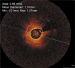 Abb. 6: In-Stent-Restenose