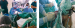 Fig. 1: Awake Craniotomy