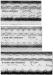 Fig. 5: Betablocker - Phonokardiographie