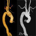 Abb. 2: Truncus brachiocephalicus